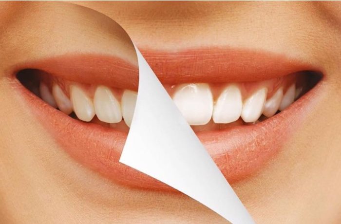 5 Simple Ways to Brighten Your Smile at Home