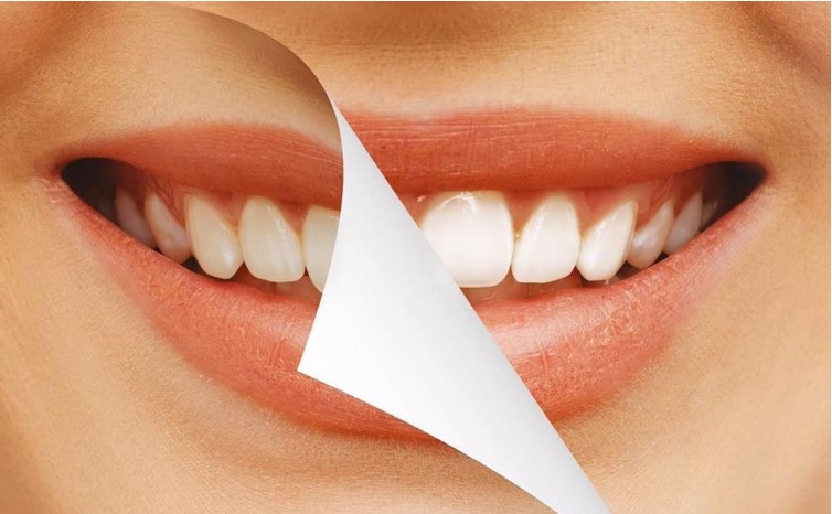5 Simple Ways to Brighten Your Smile at Home